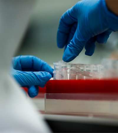 Mantenimiento Preventivo de Cromatógrafos